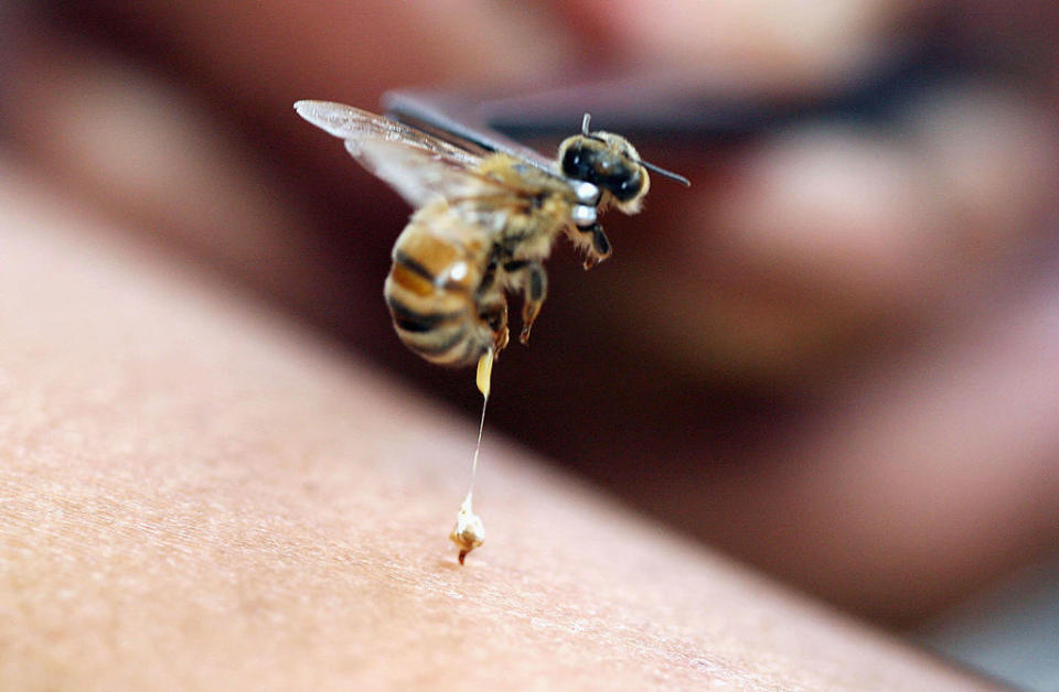 A bee is captured in flight after stinging a person's skin, with the stinger visibly released and left behind