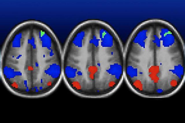 Some types of brain research need thousands of participants to be reliable