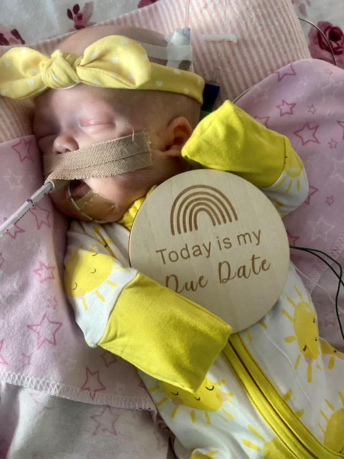 Baby Nola is resting on her original Dec. 26 due date in AdventHealth for Children's neonatal intensive care unit in Orlando.