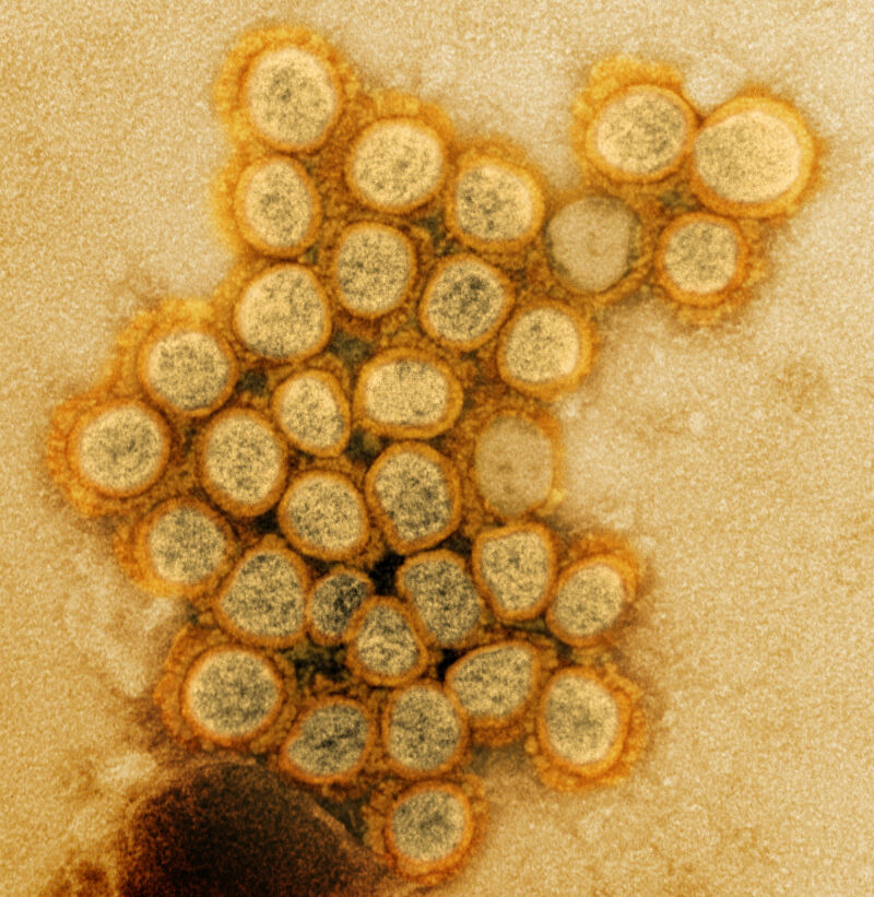 Transmission electron micrograph of a variant strain of SARS-CoV-2 virus particles (VK B.1.1.7) isolated from a patient sample and grown in cell culture.  Image taken at the NIAID Integrated Research Facility (IRF) in Fort Detrick, Maryland. 