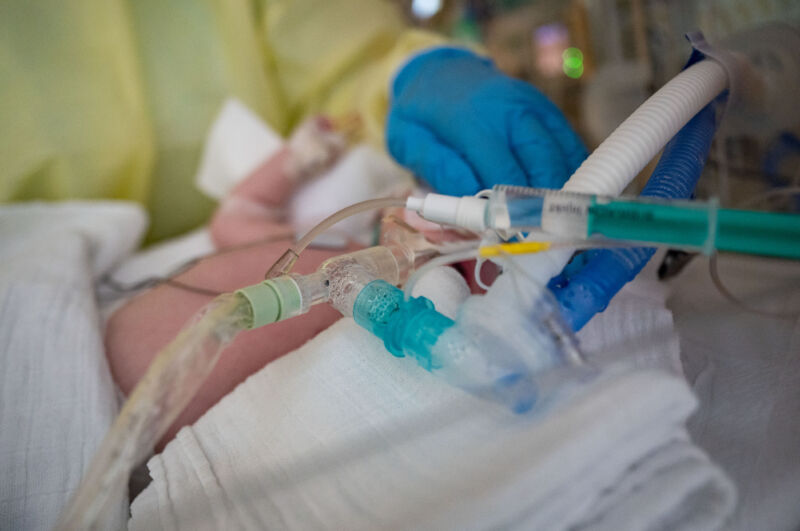 An intensive care nurse cares for a patient suffering from respiratory syncytial virus (RSV), who is on a ventilator in the children's intensive care unit of the Olga Hospital of the Stuttgart Clinic in Germany.