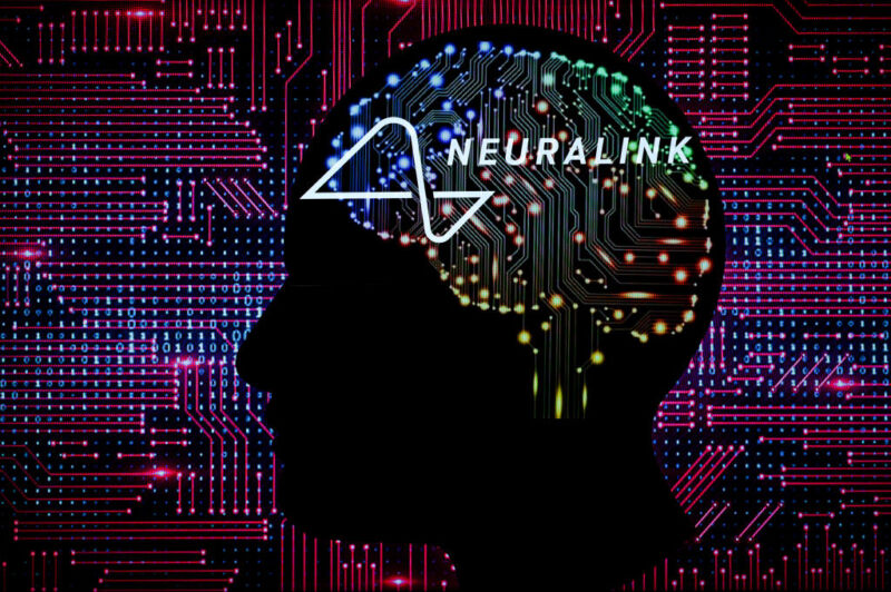 Cartoon of a brain made of electronics, with the neuralink company logo on it