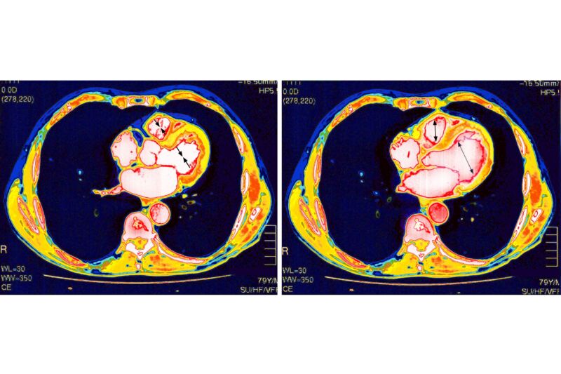 Heart scan.