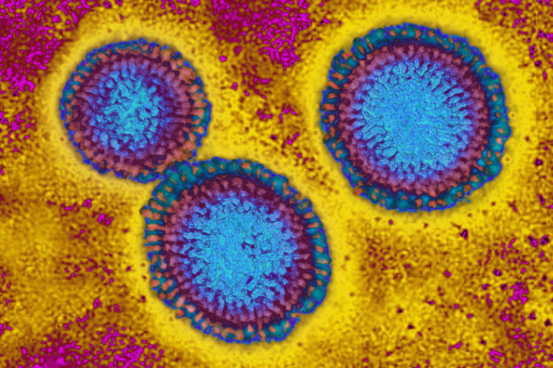 The influenza virus from an image produced by transmission electron microscopy. The viral diameter ranges from about 80 to 120 nm.